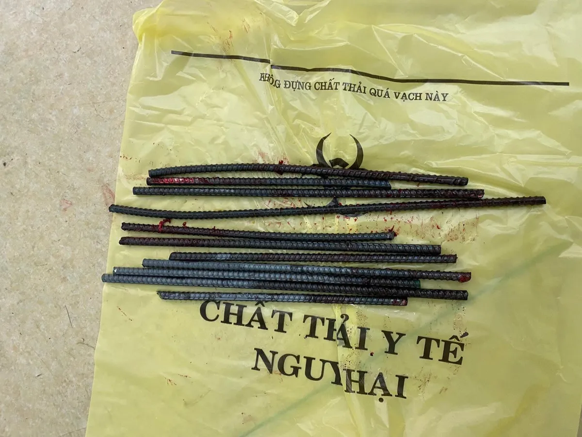 Va chạm với xe ba gác chở sắt, nam thanh niên bị 11 thanh sắt đâm xuyên chân - Ảnh 1. Va chạm với xe ba gác chở sắt, nam thanh niên bị 11 thanh sắt đâm xuyên chân - Ảnh 1.
