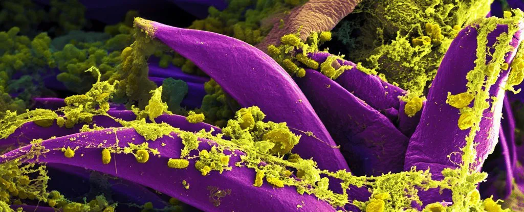 Ph&aacute;t triển loại vaccine dịch hạch mới sẵn s&agrave;ng thử nghiệm tr&ecirc;n người - Ảnh 1.