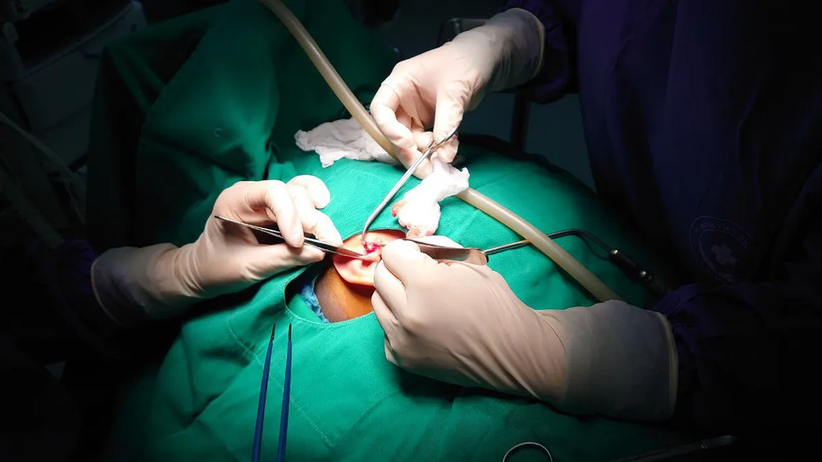 Kh&ocirc;ng chủ quan với dị tật r&ograve; lu&acirc;n nhĩ ở trẻ em - Ảnh 1.