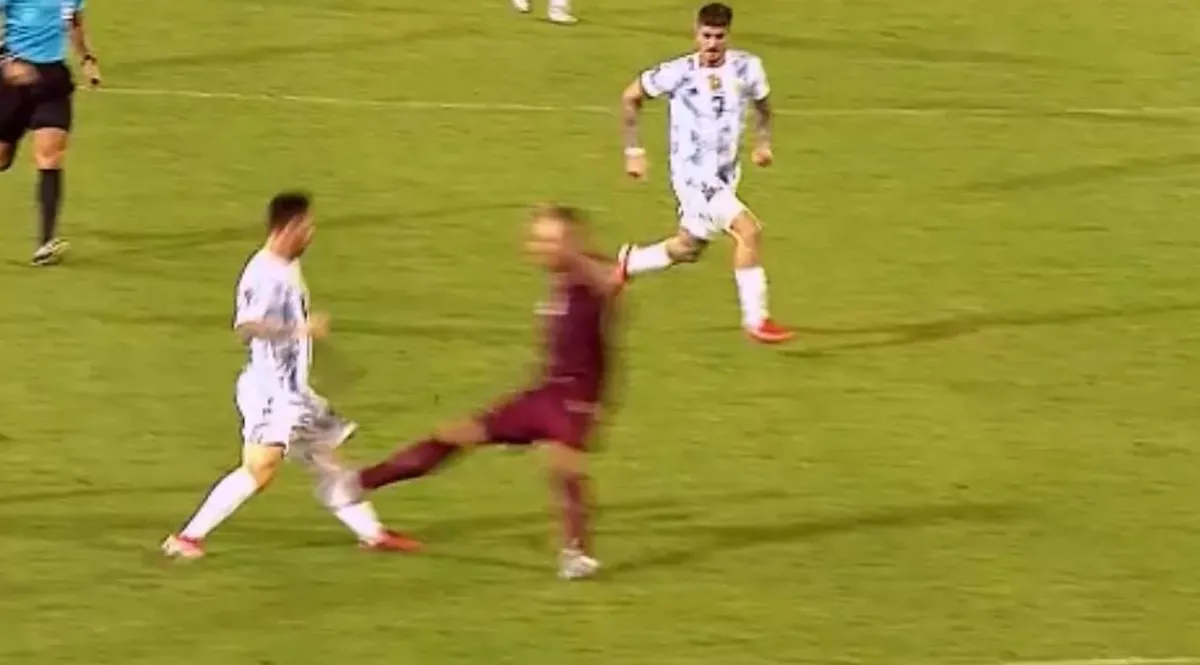 Messi suýt gãy chân trong trận thắng của Argentina - Ảnh 1. Messi suýt gãy chân trong trận thắng của Argentina - Ảnh 1.
