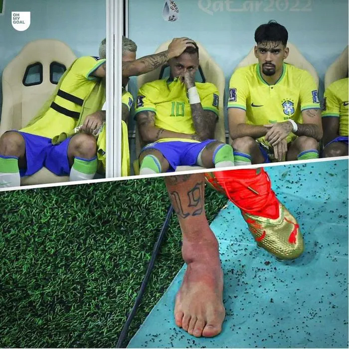 ĐT Brazil trả giá đắt sau chiến thắng Serbia - Ảnh 3. ĐT Brazil trả giá đắt sau chiến thắng Serbia - Ảnh 3.