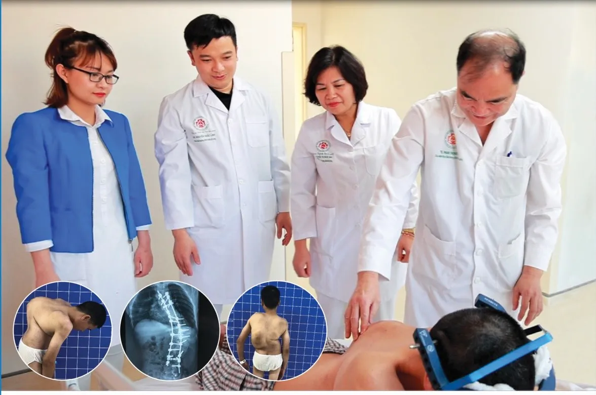 Phẫu thuật lấy lại hình dáng cho người đàn ông bị gù vẹo cột sống - Ảnh 1. Phẫu thuật lấy lại hình dáng cho người đàn ông bị gù vẹo cột sống - Ảnh 1.