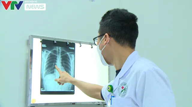 Tổn thương phổi 60%, đi cầu thang lên tầng 2 cũng hụt hơi... nhiều di chứng đáng ngại hậu COVID-19 - Ảnh 2. Tổn thương phổi 60%, đi cầu thang lên tầng 2 cũng hụt hơi... nhiều di chứng đáng ngại hậu COVID-19 - Ảnh 2.