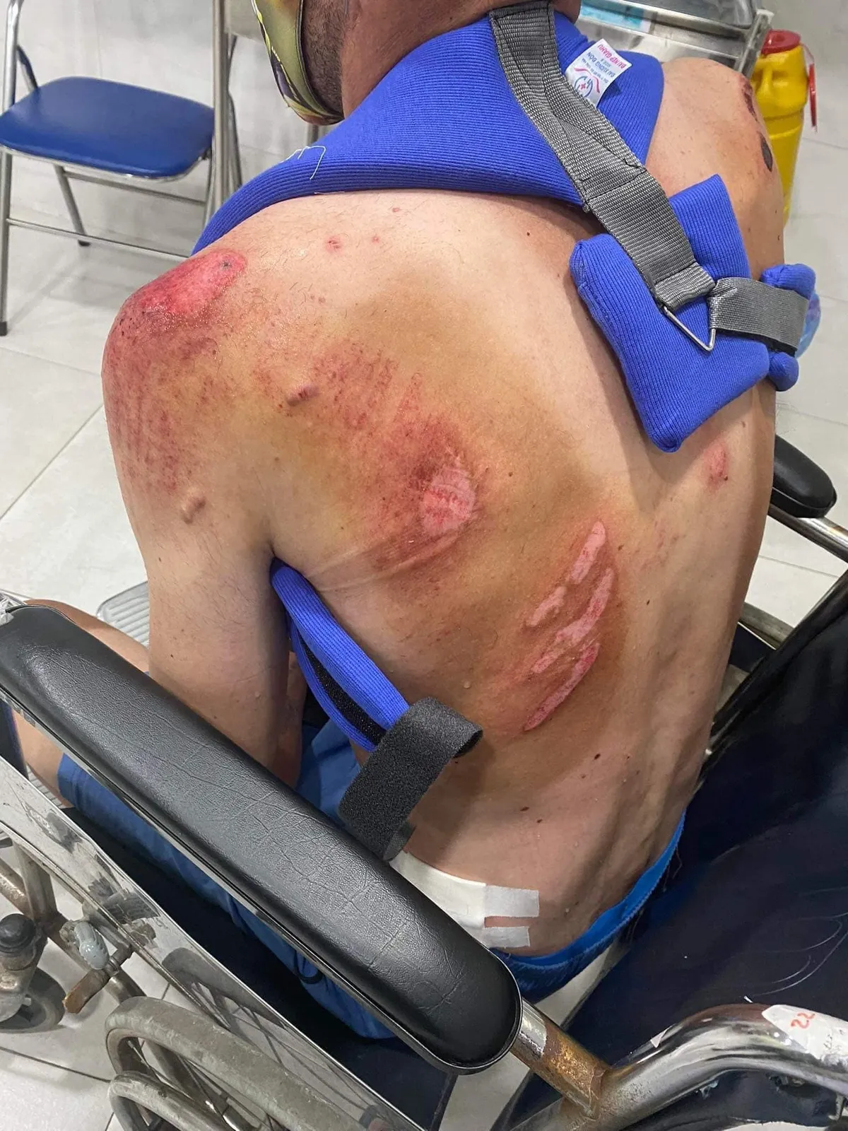 Tay đua Javier Sarda Perez gặp tai nạn khi tập luyện - Ảnh 1. Tay đua Javier Sarda Perez gặp tai nạn khi tập luyện - Ảnh 1.