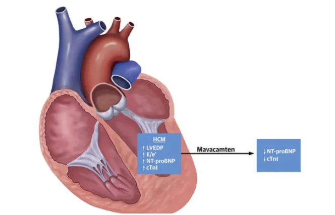 Mỹ phê duyệt thuốc điều trị bệnh tim đường uống của Bristol Myers - Ảnh 1.