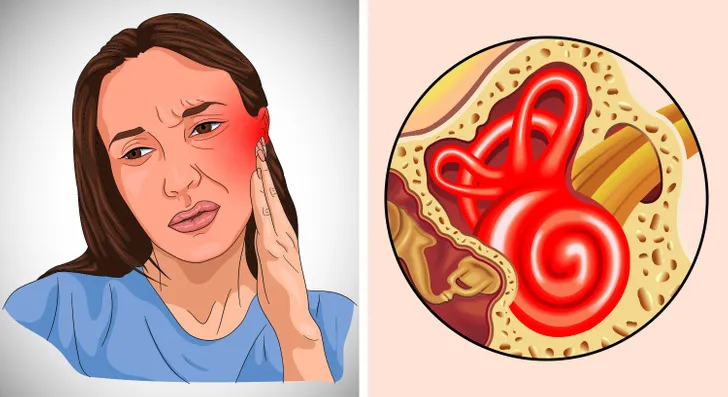 Những lí do không nên dùng tăm bông để ngoáy tai - Ảnh 2.