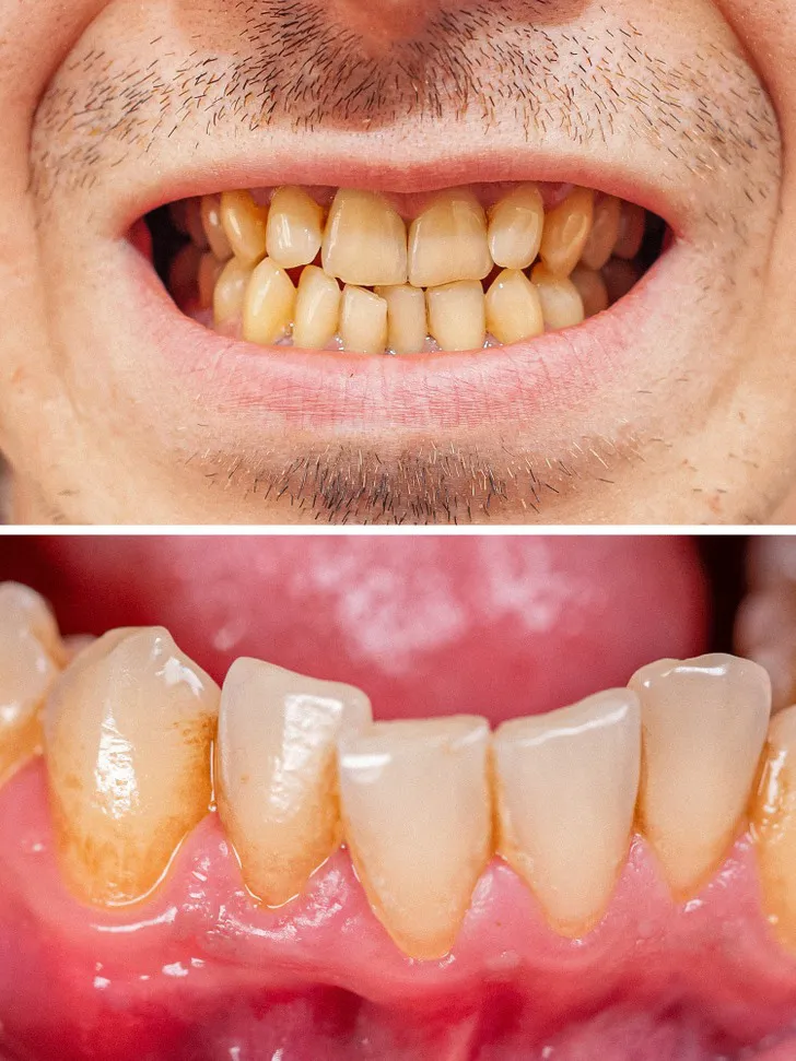8 mẹo chăm sóc răng miệng đơn giản mà hiệu quả đến bất ngờ - Ảnh 6.