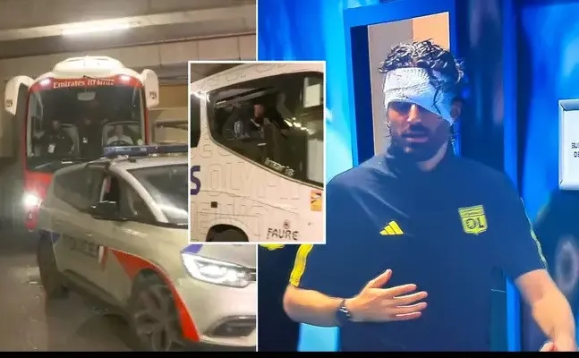 HLV Fabio Grosso của Lyon chấn thương vì bị CĐV ném đá - Ảnh 3.