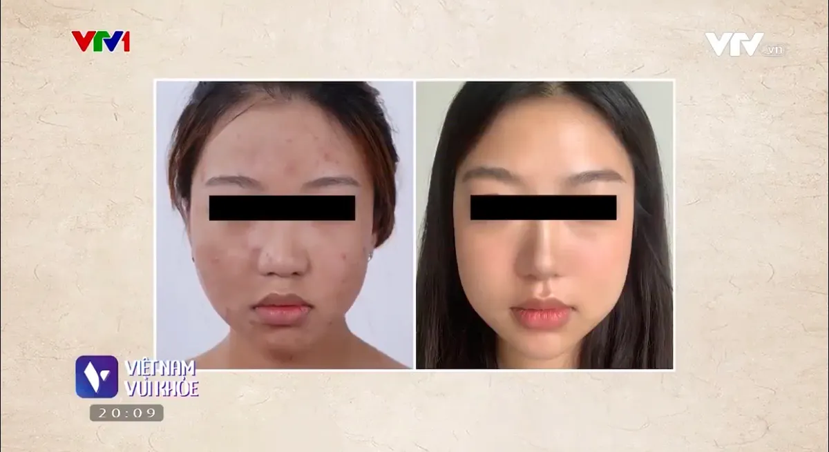 Dùng mỹ phẩm quá sớm và hệ lụy với sức khỏe làn da - Ảnh 2. Dùng mỹ phẩm quá sớm và hệ lụy với sức khỏe làn da - Ảnh 2.