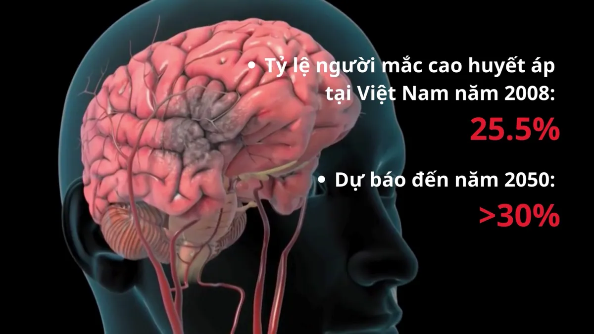Ẩn họa tăng huyết áp ở người trẻ - Ảnh 2.