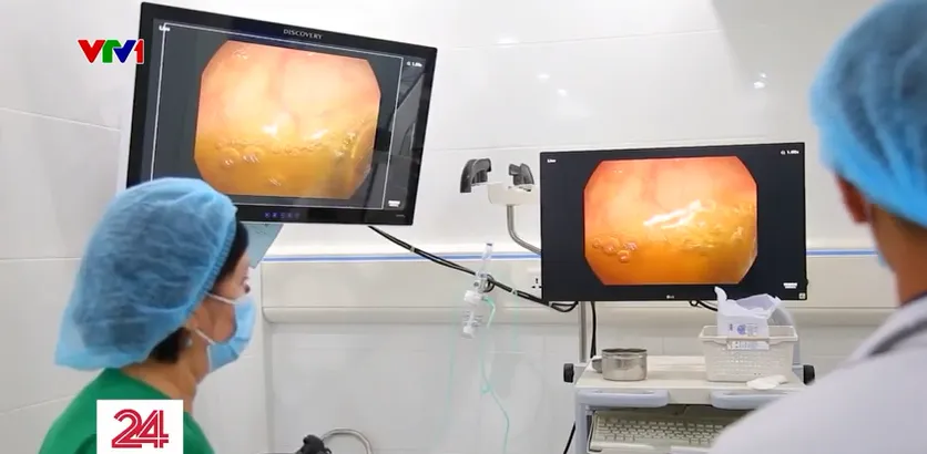 Ứng dụng AI trong nội soi tiêu hóa và chẩn đoán ung thư sớm - Ảnh 1.