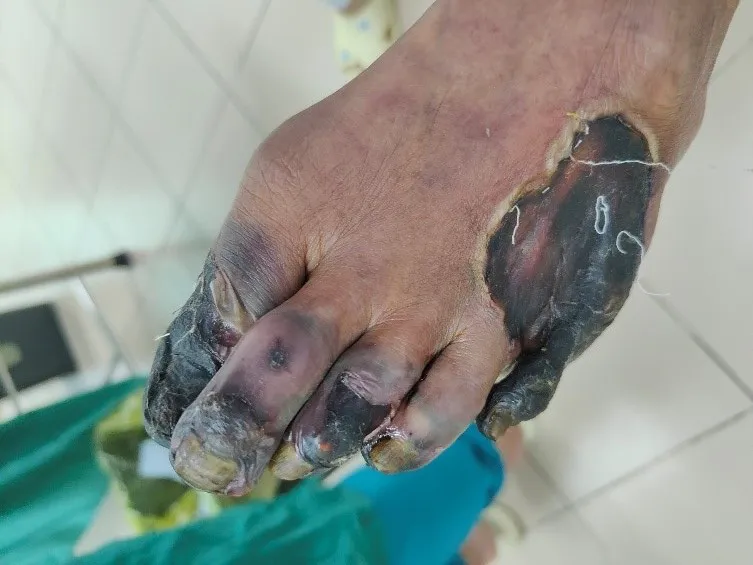 Nguy hiểm khôn lường khi dùng thuốc đông y điều trị không đúng chỉ định - Ảnh 1.