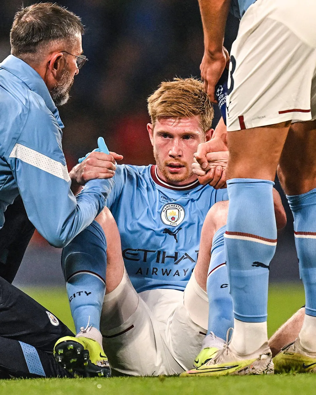 Chấn thương của De Bruyne có thể nghiêm trọng hơn dự kiến - Ảnh 1. Chấn thương của De Bruyne có thể nghiêm trọng hơn dự kiến - Ảnh 1.