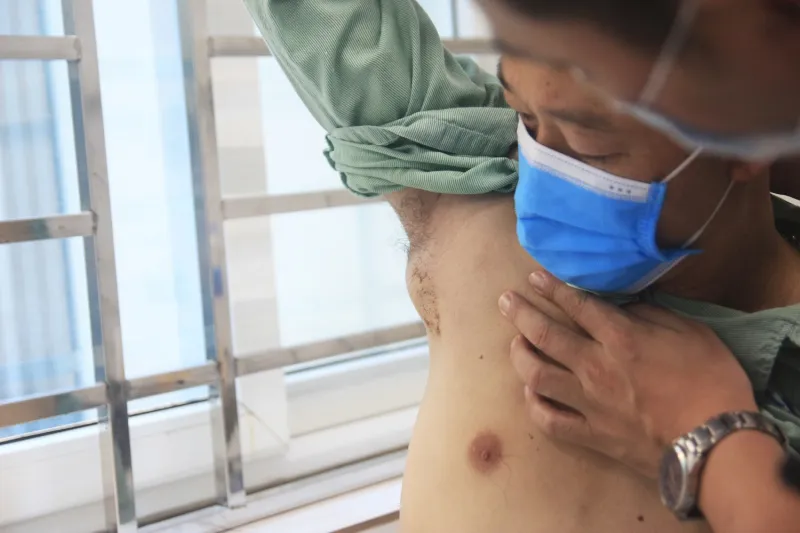 Người đàn ông mắc bệnh mèo cào hiếm gặp - Ảnh 1. Người đàn ông mắc bệnh mèo cào hiếm gặp - Ảnh 1.
