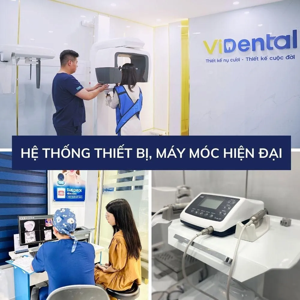 Đánh giá kỹ thuật nhổ răng khôn xâm lấn tối thiểu tại nha khoa ViDental - Ảnh 4. Đánh giá kỹ thuật nhổ răng khôn xâm lấn tối thiểu tại nha khoa ViDental - Ảnh 4.