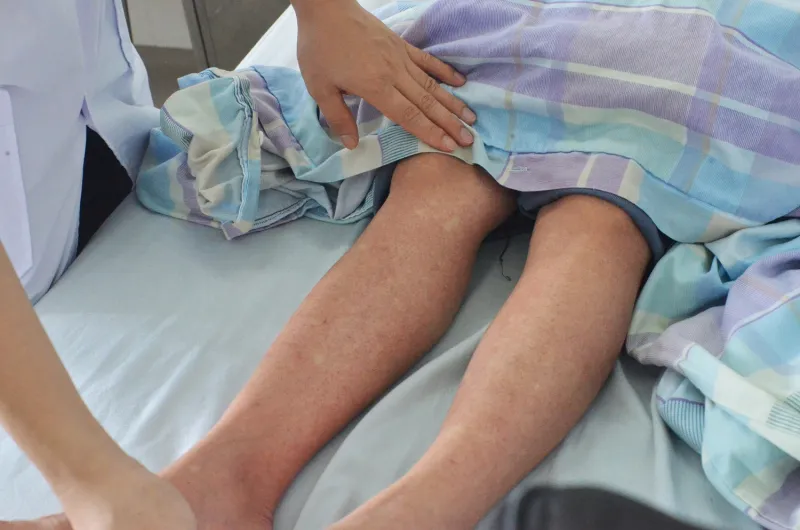Cảnh báo biến chứng sốc do sốt xuất huyết đe dọa tính mạng - Ảnh 1. Cảnh báo biến chứng sốc do sốt xuất huyết đe dọa tính mạng - Ảnh 1.