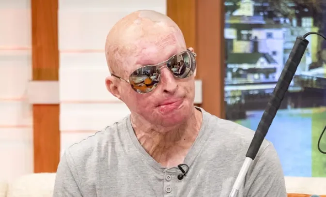 Anh ghi nhận tỷ lệ tấn c&ocirc;ng bằng axit cao nhất thế giới - Ảnh 1.