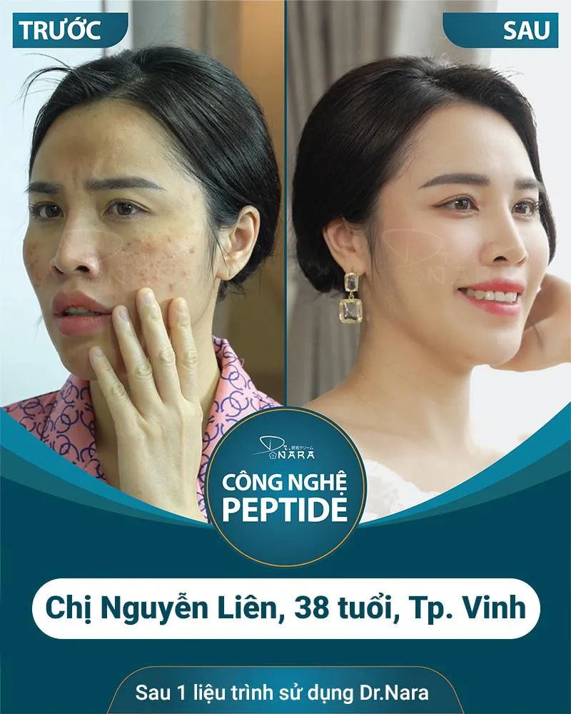 Công nghệ COLLAGEN PEPTIDE đến từ Nhật Bản - bí mật đằng sau sự thành công của thương hiệu DR.NARA - Ảnh 3.