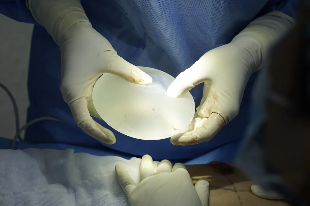 Sự mềm mại của v&ograve;ng 1 sau n&acirc;ng ngực phụ thuộc v&agrave;o c&aacute;c yếu tố n&agrave;o? - Ảnh 3.