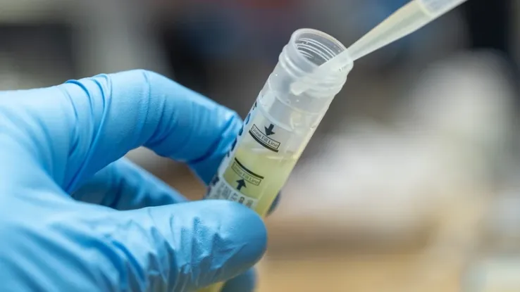 Số ca bệnh l&acirc;y truyền qua đường t&igrave;nh dục gia tăng ở EU - Ảnh 1.