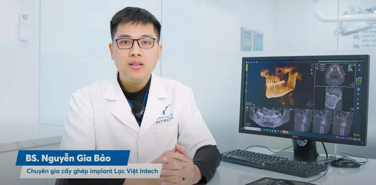 Tại sao công nghệ USI giúp đặt implant An toàn, không sưng, không đau, không chảy máu? - Ảnh 1. Tại sao công nghệ USI giúp đặt implant An toàn, không sưng, không đau, không chảy máu? - Ảnh 1.
