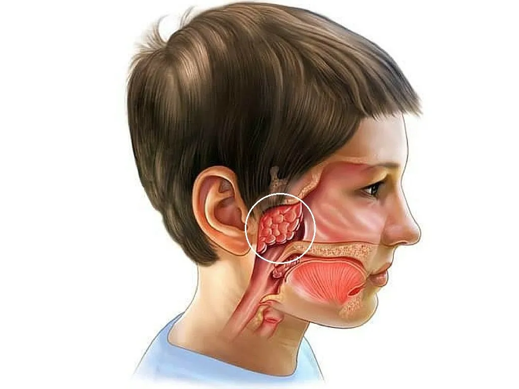 Trẻ có nên nạo VA sớm hay không? Lời khuyên của Thạc sĩ BS Nguyễn Xuân Đạt - Ảnh 1.