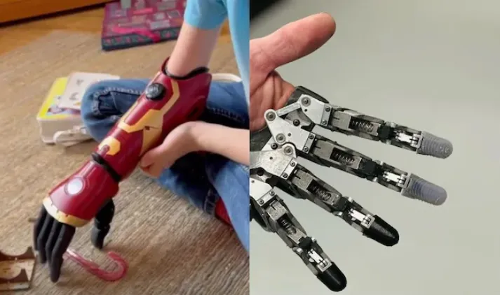 Jordan Marotta - cậu bé nhỏ tuổi nhất thế giới nhận cánh tay sinh học  - Ảnh 1.