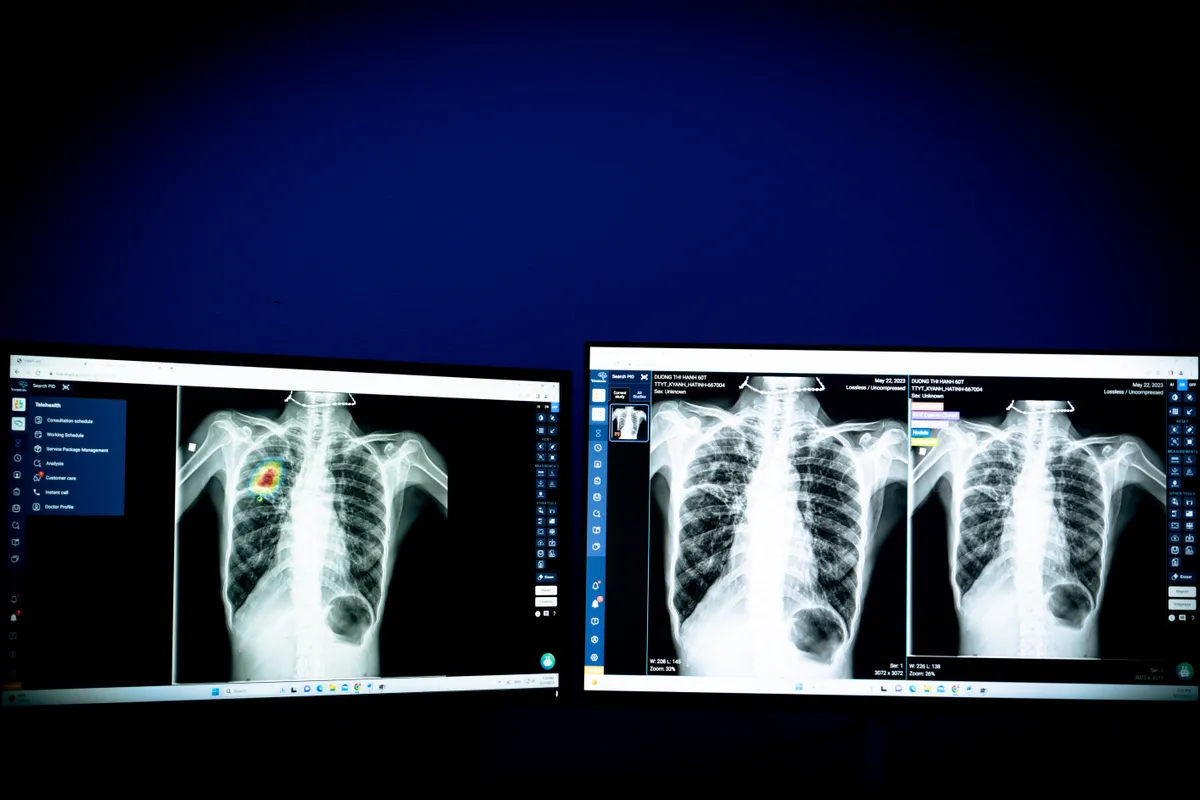 Ứng dụng AI trong lĩnh vực y tế: Bước đột phá trong chăm sóc sức khỏe con người - Ảnh 2.