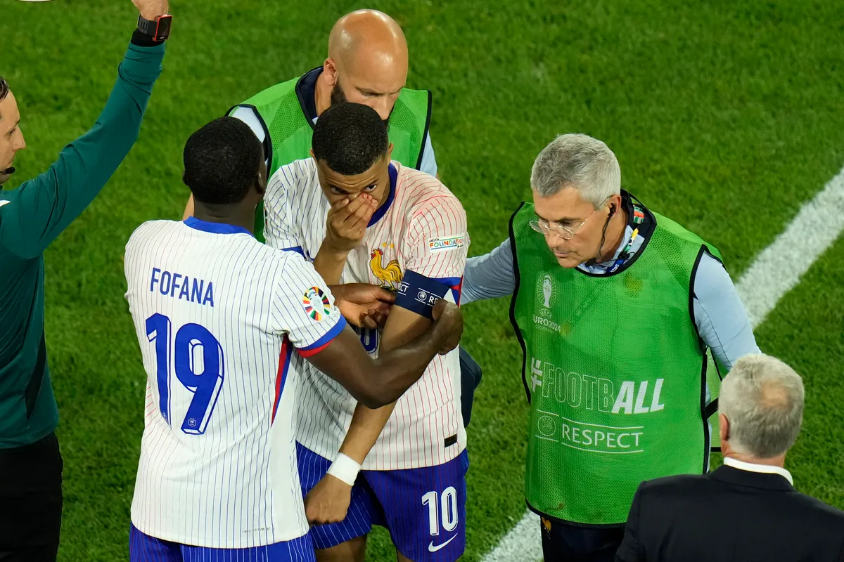 Kylian Mbappe bị gãy mũi ngay trận ra quân ở Euro 2024 - Ảnh 1. Kylian Mbappe bị gãy mũi ngay trận ra quân ở Euro 2024 - Ảnh 1.