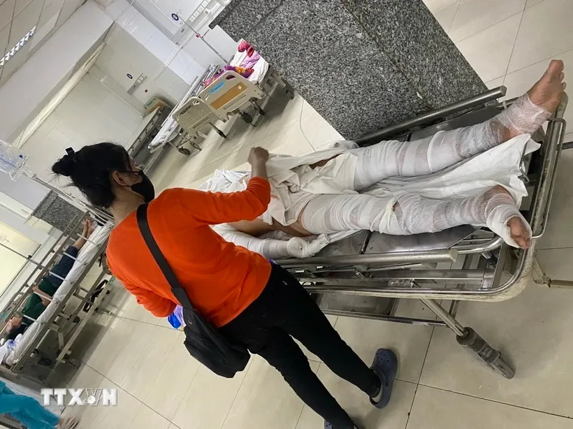 Xác định nguyên nhân vụ tai nạn lao động ở Bình Dương làm 9 người bị thương - Ảnh 1.