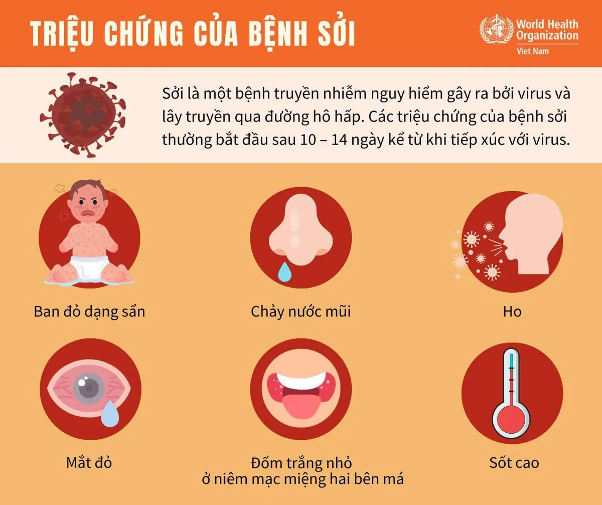 Infographic: Triệu chứng của bệnh sởi- Ảnh 1. Infographic: Triệu chứng của bệnh sởi- Ảnh 1.
