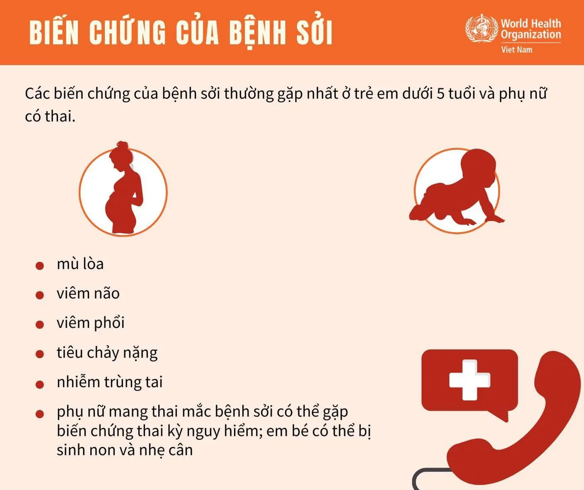 Infographic: Triệu chứng của bệnh sởi- Ảnh 2. Infographic: Triệu chứng của bệnh sởi- Ảnh 2.