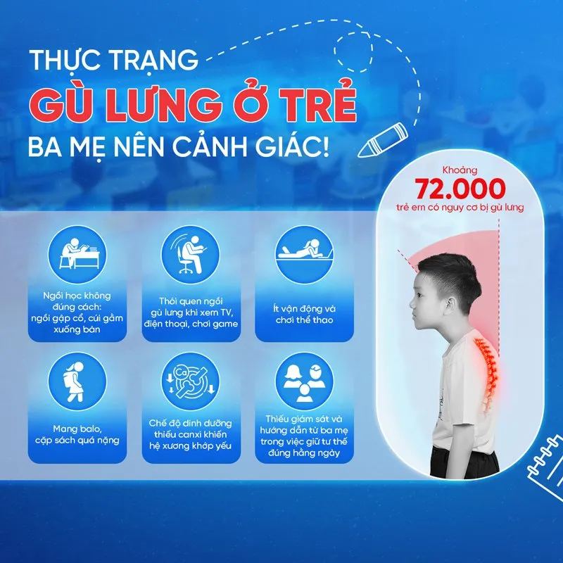 Khi n&agrave;o cần trang bị đai chống g&ugrave; lưng PITA-SAPO cho trẻ? - Ảnh 1.