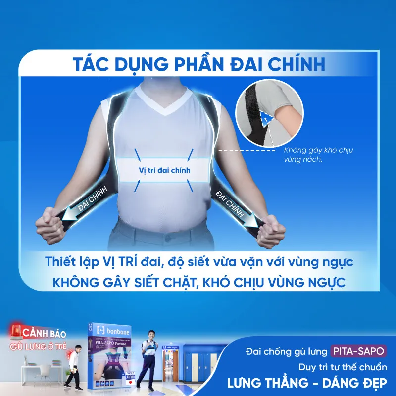 Khi n&agrave;o cần trang bị đai chống g&ugrave; lưng PITA-SAPO cho trẻ? - Ảnh 4.