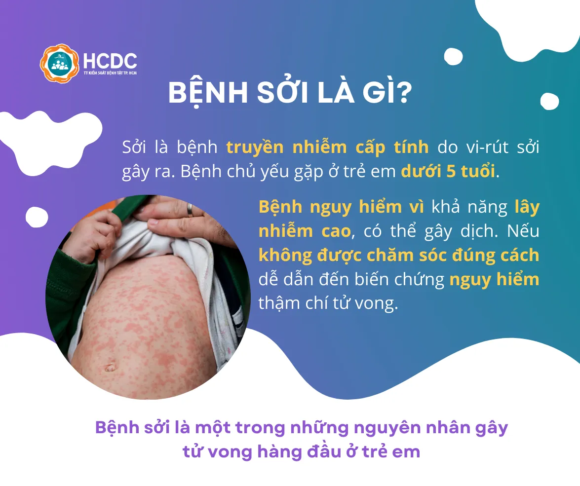 Infographic: Tiêm vaccine sởi ngay khi trẻ đủ 9 tháng tuổi - Ảnh 2. Infographic: Tiêm vaccine sởi ngay khi trẻ đủ 9 tháng tuổi - Ảnh 2.