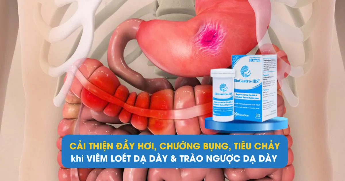 Cải thiện đầy hơi, chướng bụng khi mắc vi&ecirc;m dạ d&agrave;y, tr&agrave;o ngược dạ d&agrave;y thực quản - Ảnh 1.