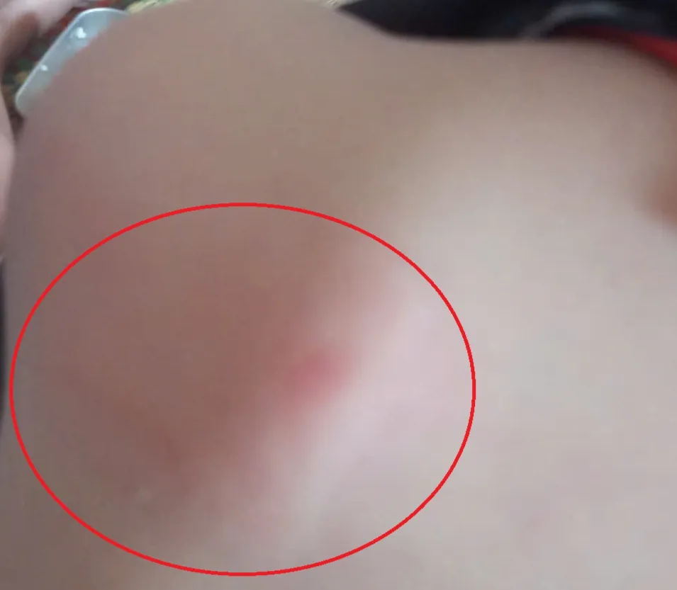 Đắk Lắk: Thầy gi&aacute;o đ&aacute;nh học sinh bầm lưng vai - Ảnh 1.