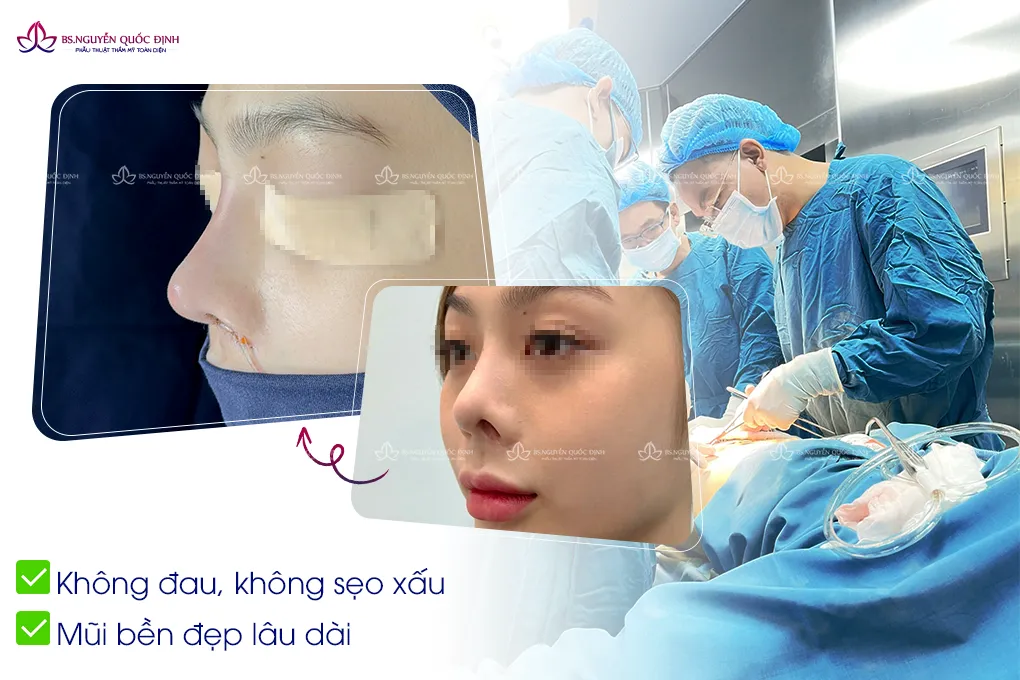 Bị hỏng mũi sau phẫu thuật thẩm mỹ, chị em cần làm gì? - Ảnh 3. Bị hỏng mũi sau phẫu thuật thẩm mỹ, chị em cần làm gì? - Ảnh 3.