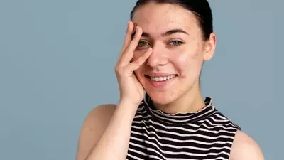 Sắc tố da không còn là nỗi lo: Mẹo chăm da giúp bạn tự tin tỏa sáng - Ảnh 2.
