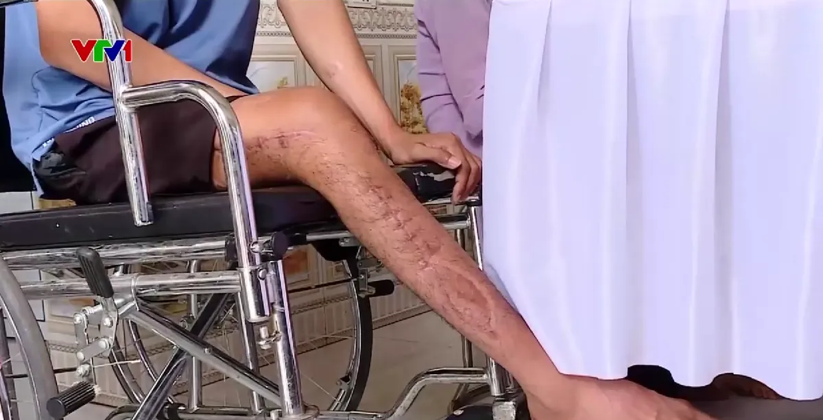 Phòng ngừa tai nạn lao động từ sớm, từ xa - Ảnh 1.