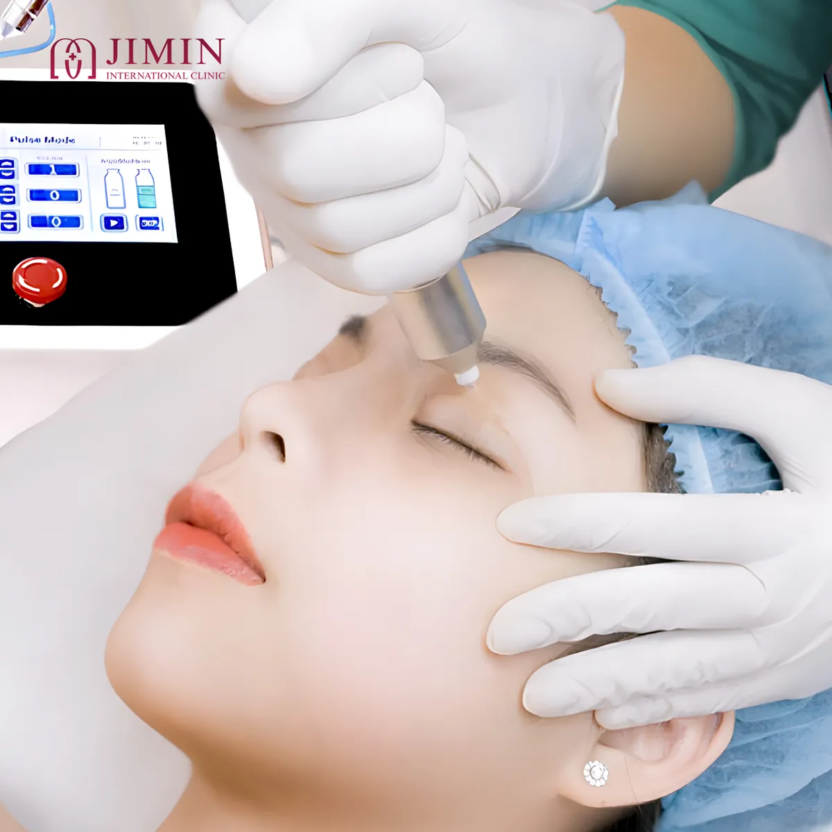 Giải pháp trẻ hóa đôi mắt tại Phòng khám chuyên khoa phẫu thuật thẩm mỹ Jimin - Ảnh 2.