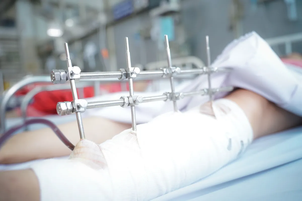 Mổ xuyên đêm cứu nạn nhân vụ sập nhà do mưa lớn ở Long An - Ảnh 1.