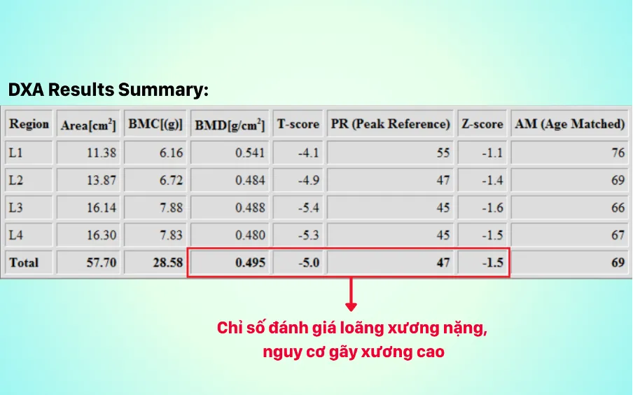 Xẹp đốt sống chỉ sau một lần hắt hơi- Ảnh 2.