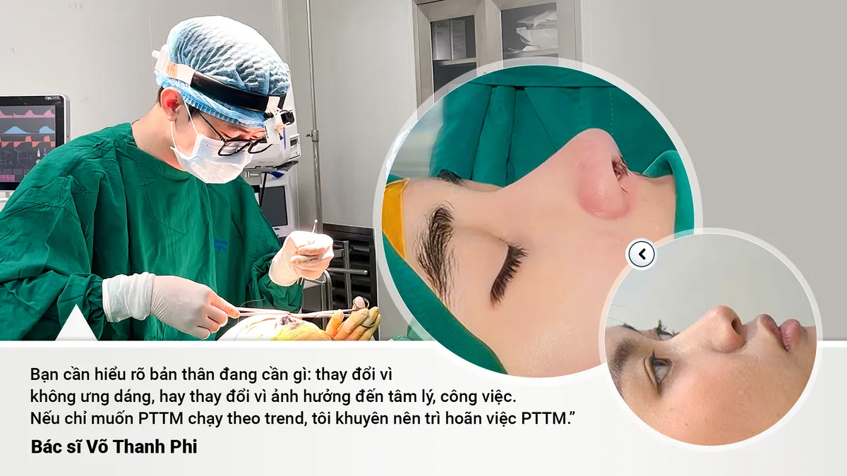 Mũi hỏng sau nâng: Khi nào nên sửa, khi nào nên chờ? - Ảnh 2.