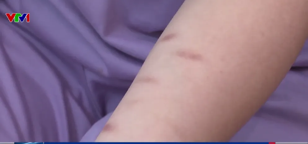 Trầm cảm vì áp lực điểm số: “Con là sản phẩm thất bại của bố mẹ”- Ảnh 1. Trầm cảm vì áp lực điểm số: “Con là sản phẩm thất bại của bố mẹ”- Ảnh 1.