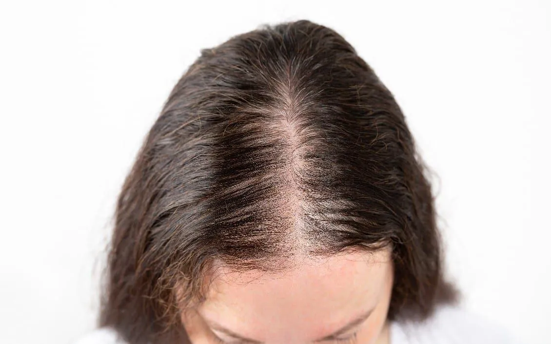 (Ảnh minh họa: columbialasercenter)