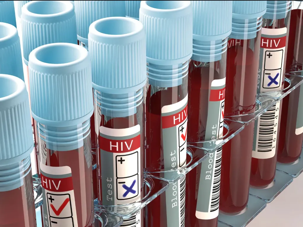 Mỹ cắt giảm tài trợ có thể đảo ngược nhiều thập kỷ thành quả trong phòng chống HIV/AIDS - Ảnh 1.