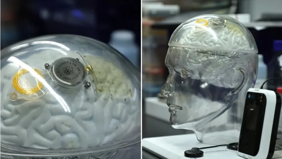 Cạnh tranh với Neuralink của Elon Musk, Trung Quốc "bắt kịp" Mỹ trong lĩnh vực cấy chip vào não người - Ảnh 1.