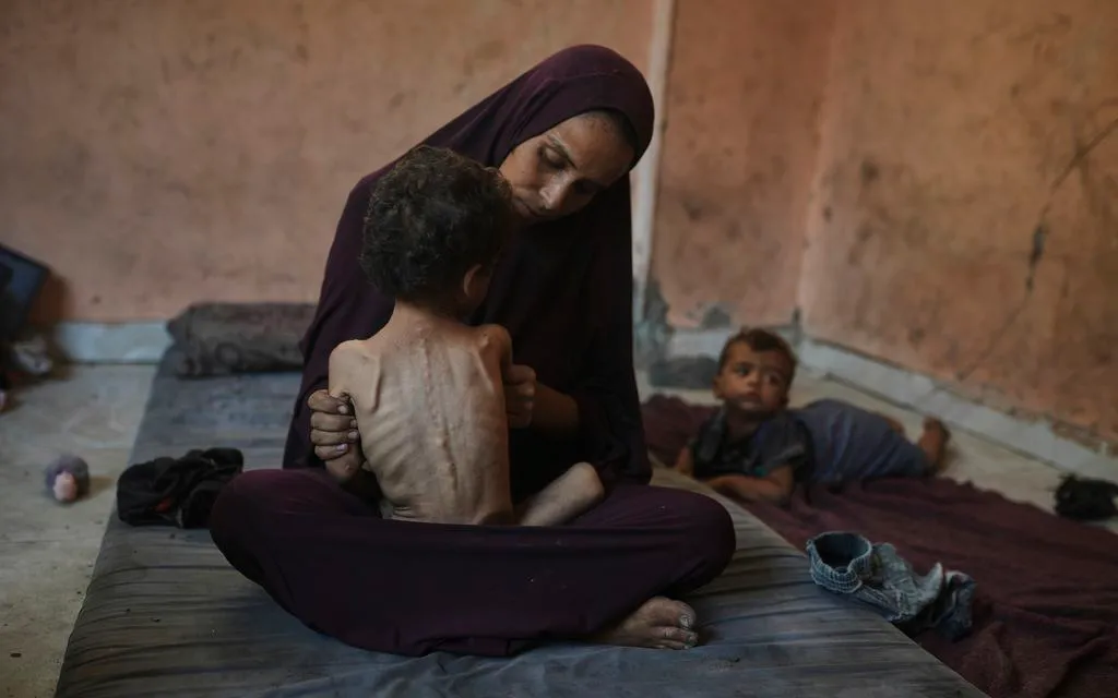 Naima Abu Ful bế con trai 2 tuổi bị suy dinh dưỡng tại trại tị nạn Shati, Gaza ngày 23/7/2025. (Ảnh: AP)