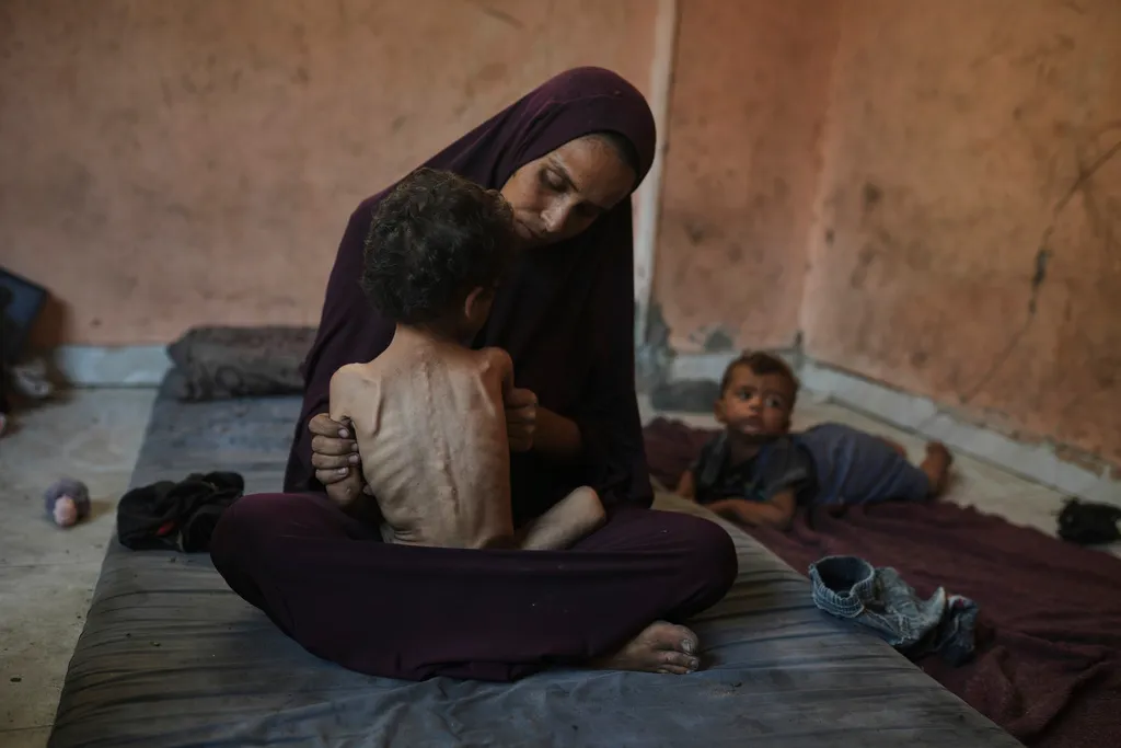 Liên hợp quốc cảnh báo viện trợ vào Gaza không đủ, trẻ em đối mặt suy dinh dưỡng nghiêm trọng - Ảnh 1.